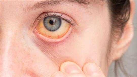 eee3a9f78ed5bc31371019be670dcc84